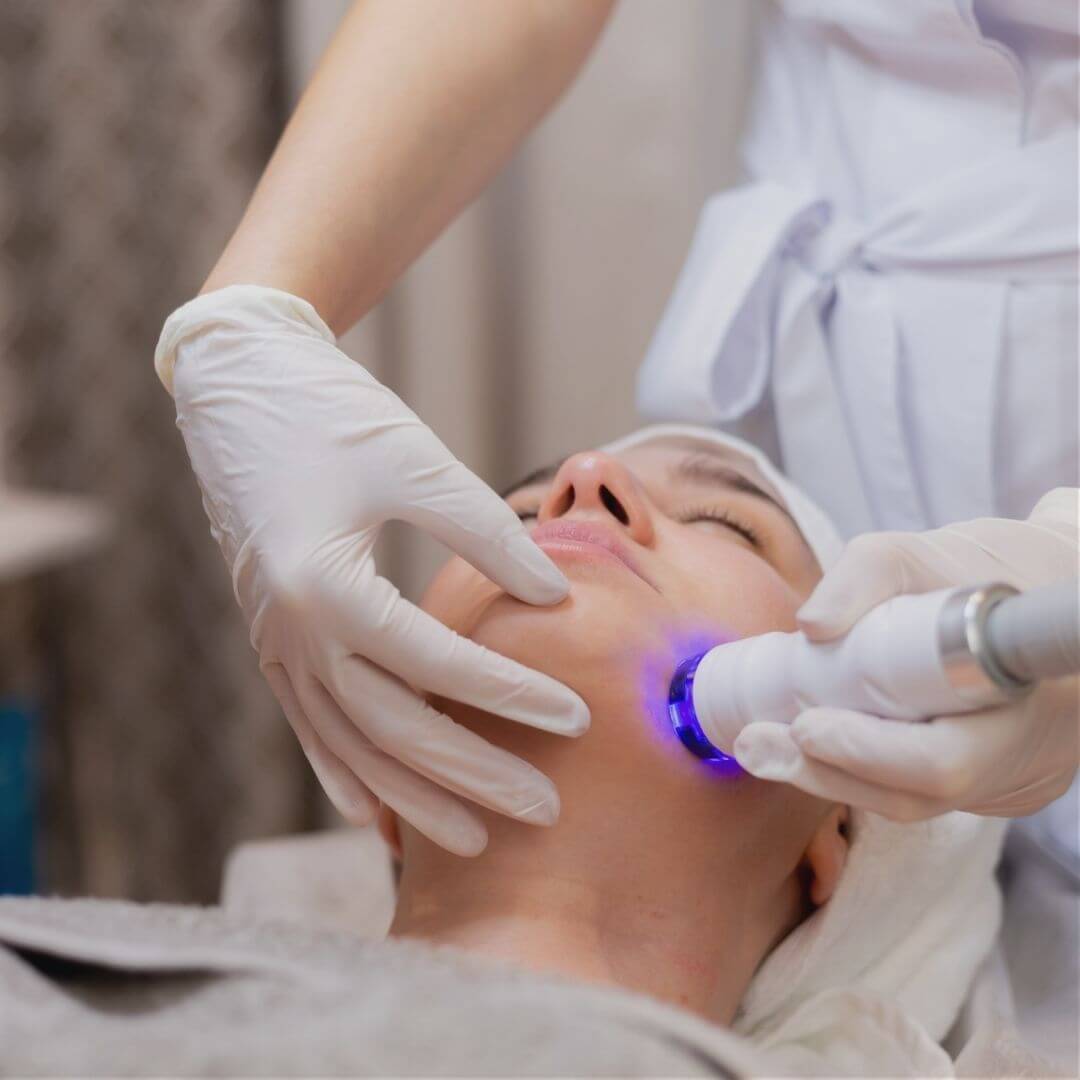 Radio Frequency Skin Treatment
