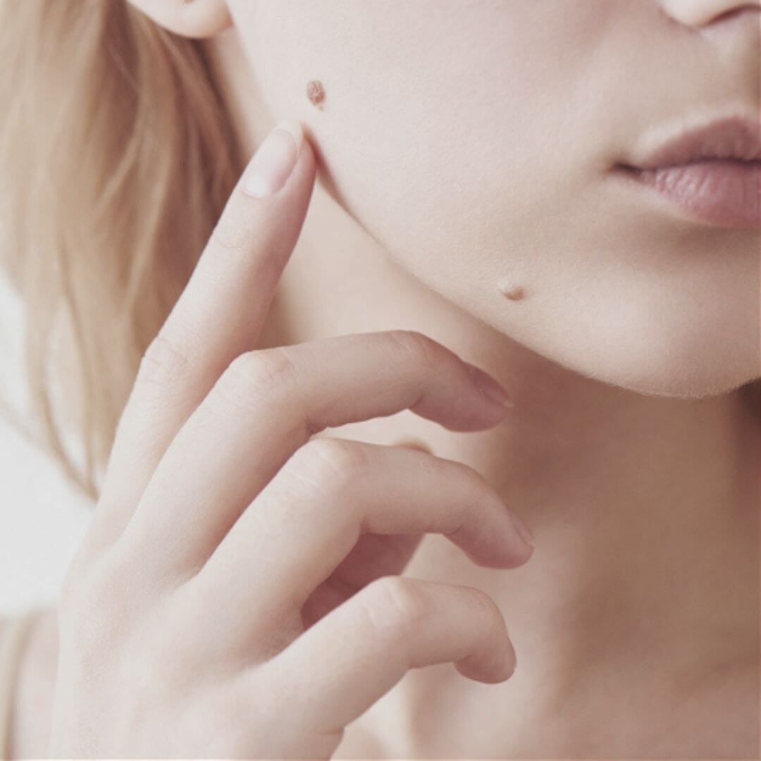 Clinical Skin Clear Treatment