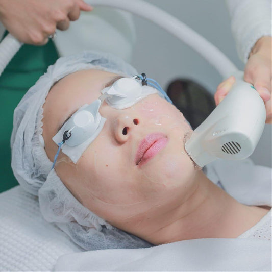 IPL Pigmentation Spot Treatment